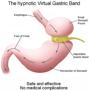 Hypnosis for Weight Loss Brighton